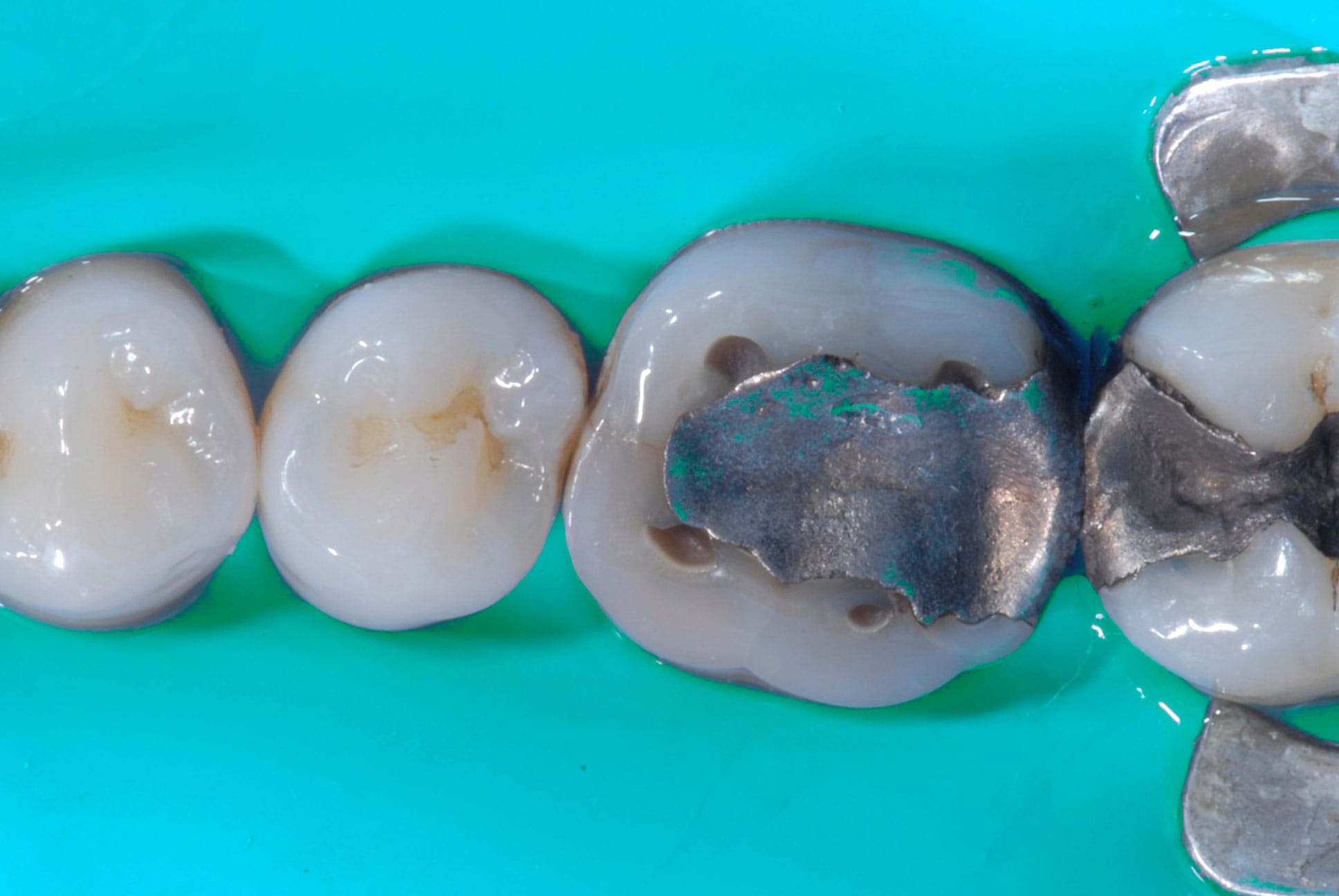 Before Image