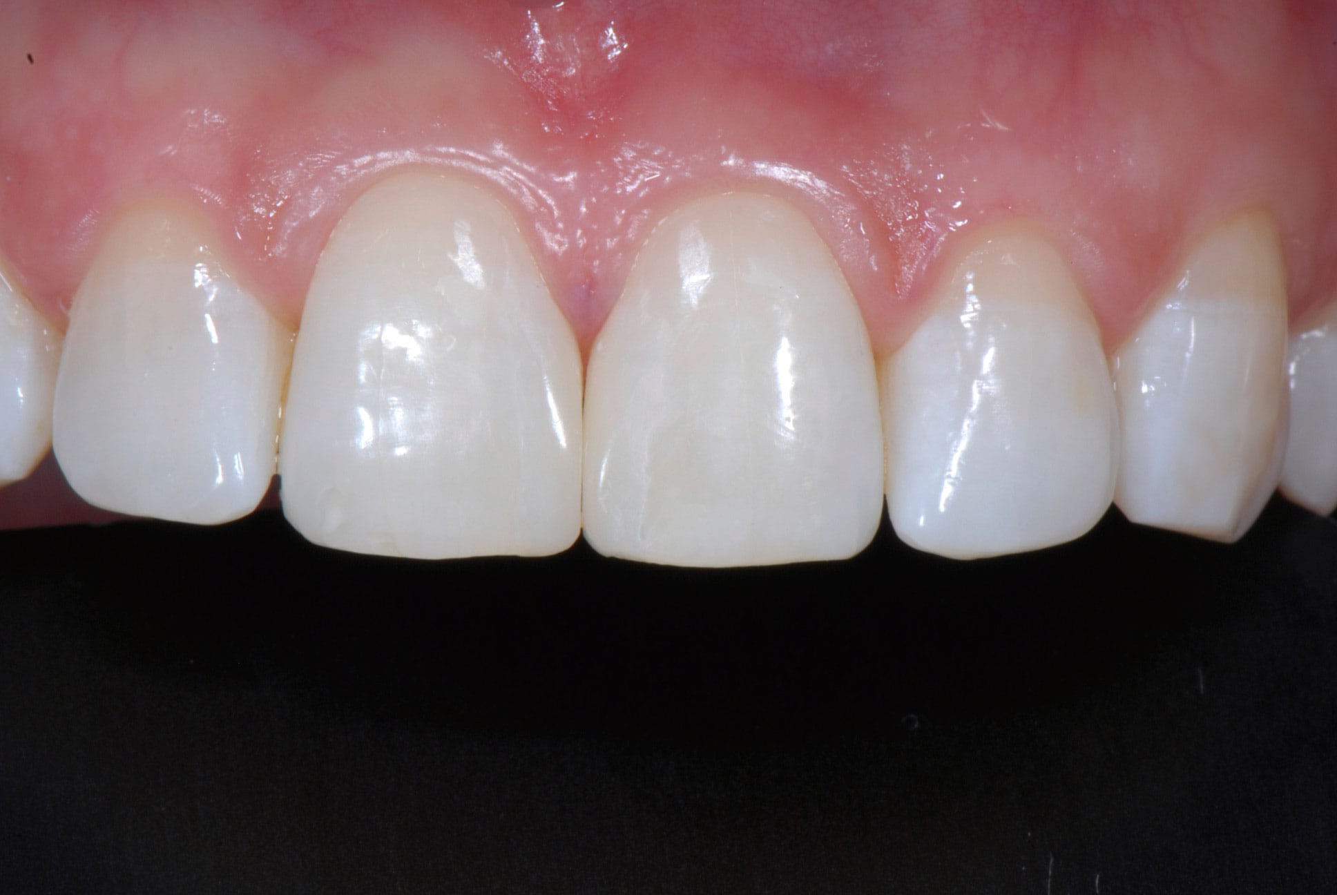 After Image