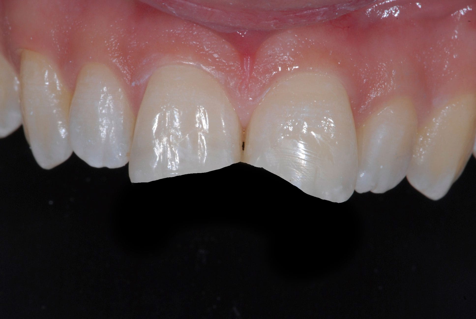 Before Image