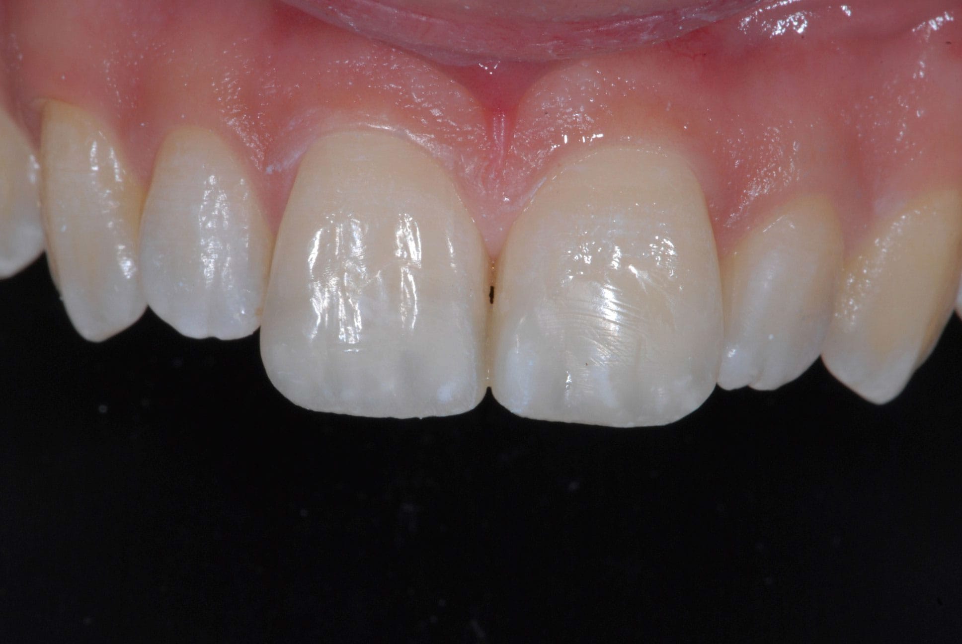 After Image