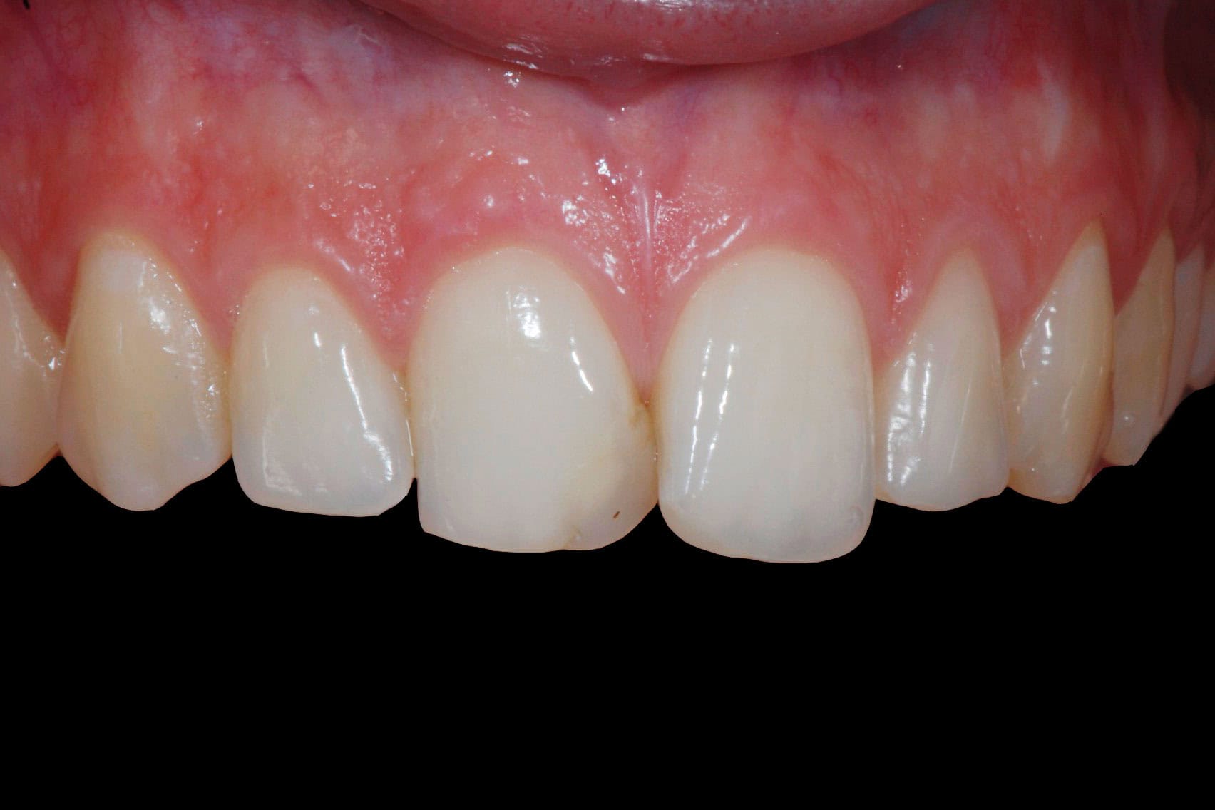 Before Image
