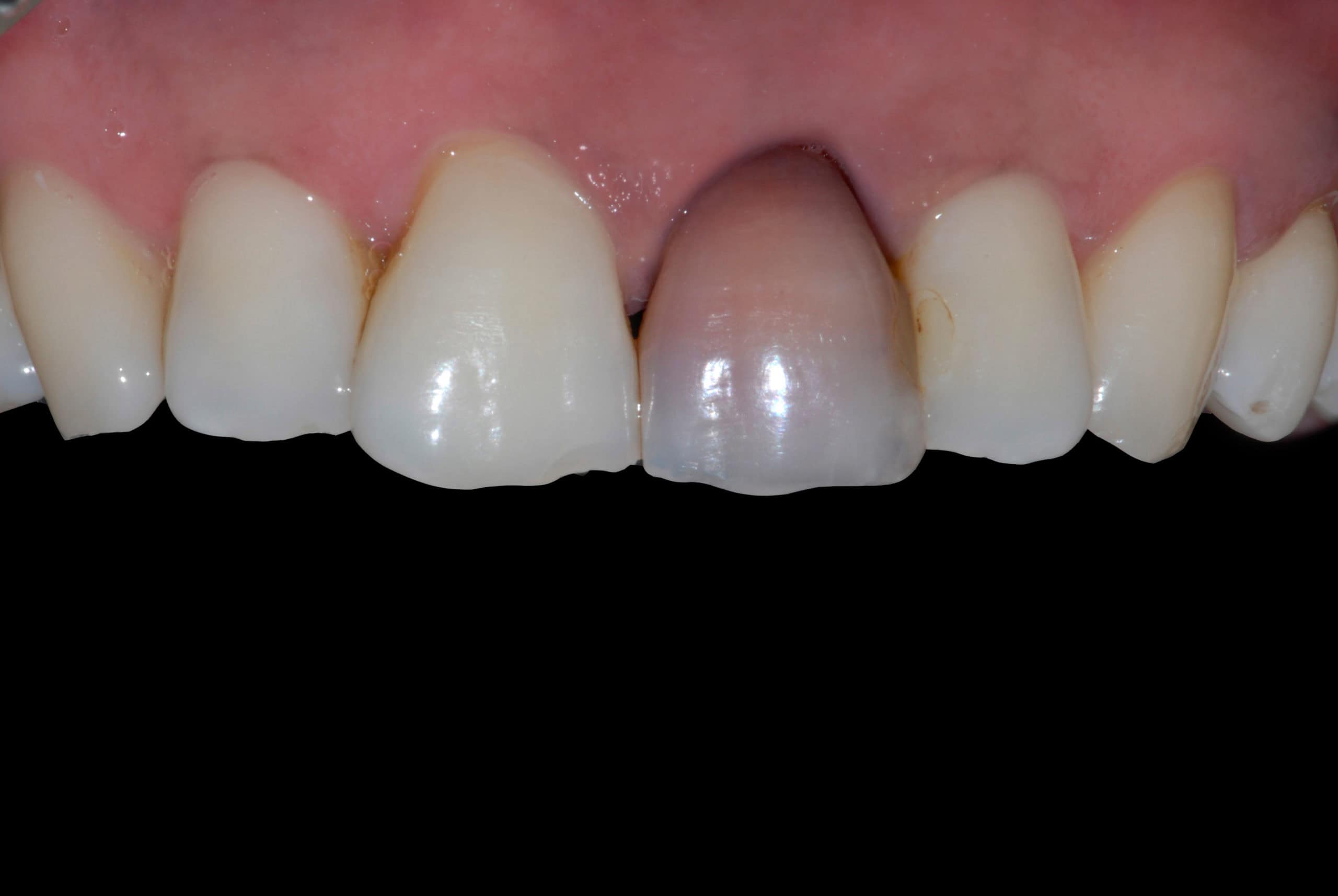 Before Image