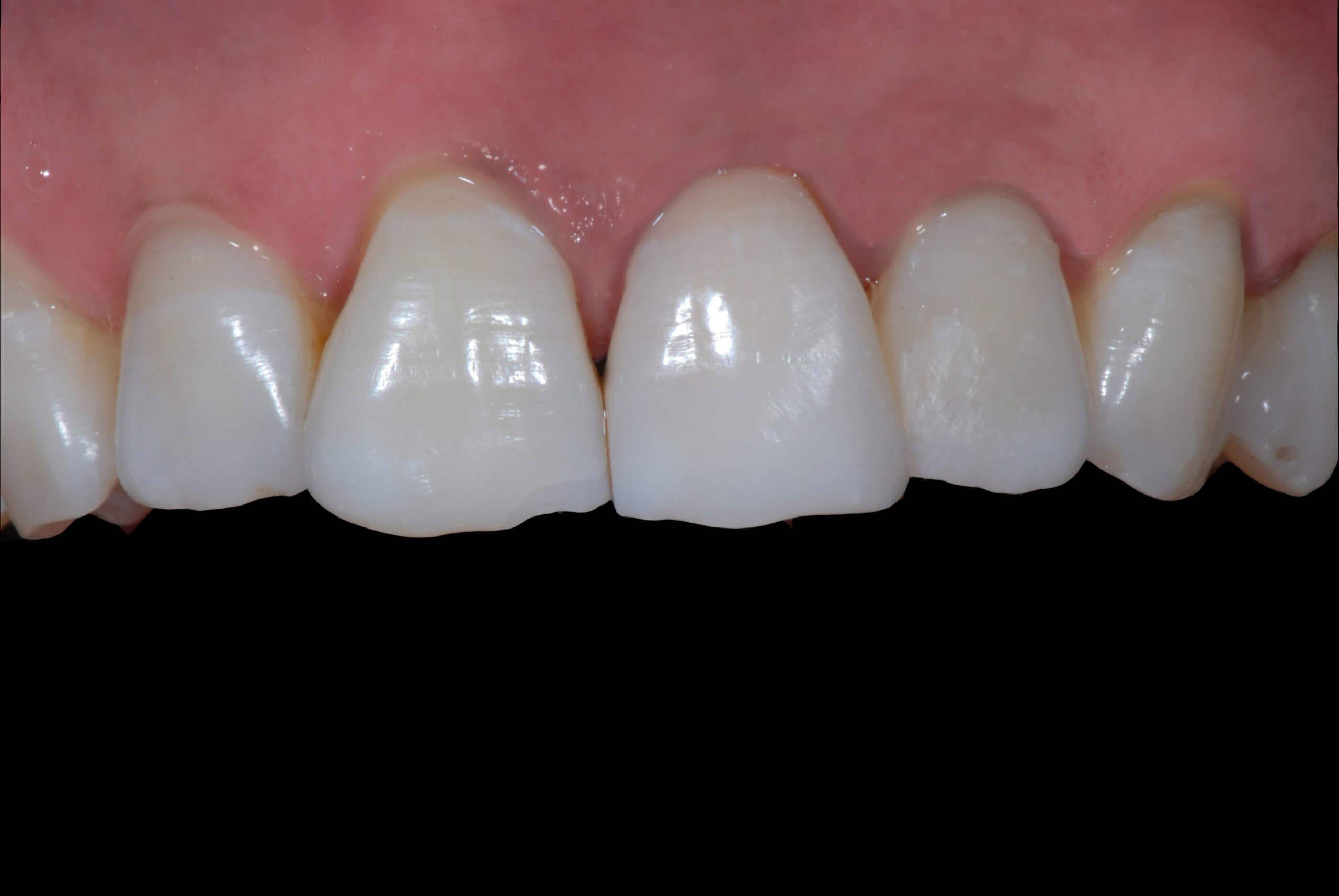 After Image