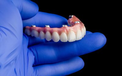 Protesi estetiche a Brescia: tornare a sorridere in modo naturale