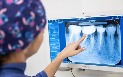 Radiologia digitale a Brescia: diagnosi precise, minori radiazioni
