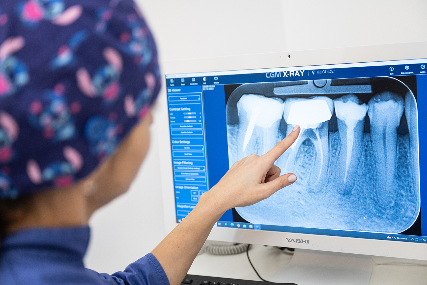 radiologia-dentista-brescia