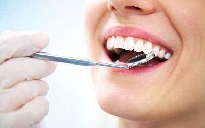 Estetica dentale a Brescia: ricostruzioni estetiche, faccette e corone per un sorriso su misura