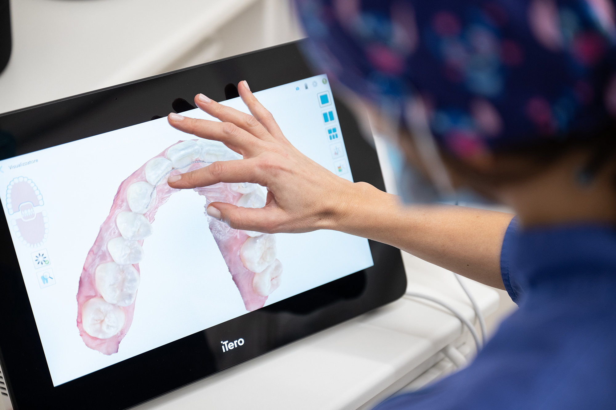 scanner-intraorale-brescia